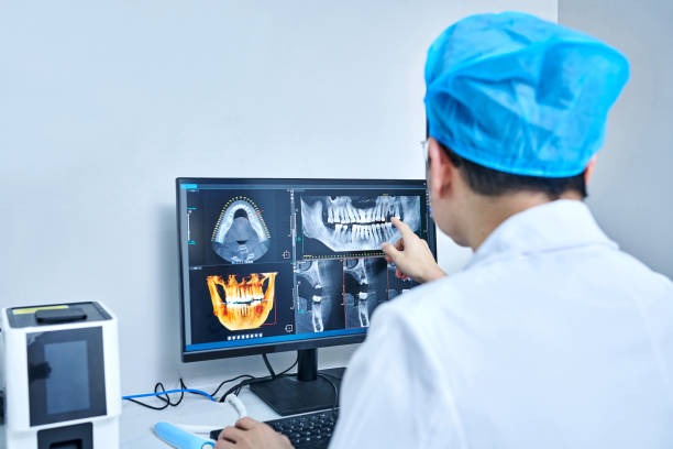 Best Knocked-Out Tooth (Avulsed Tooth) Treatment in Kenton, OH