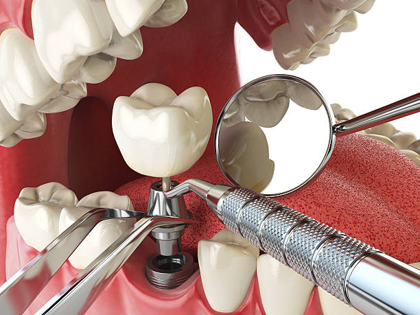 Best Emergency Treatment for Jaw Pain or Injury in Kenton, OH